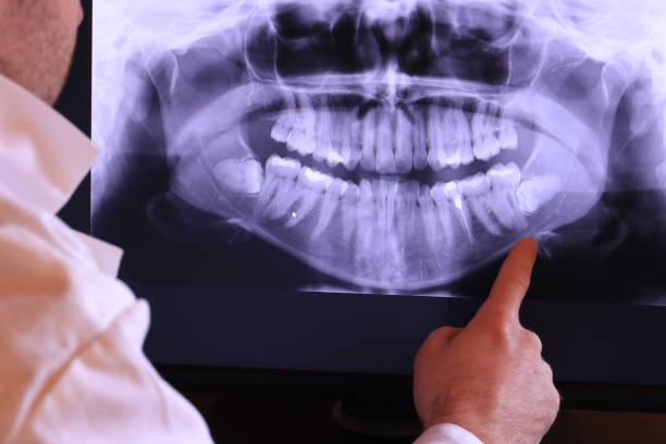 Best Orthodontic Emergency Dentist in Sheldon, IL