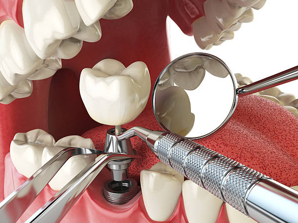 Best Emergency Dentist for Knocked-Out Tooth in Sheldon, IL